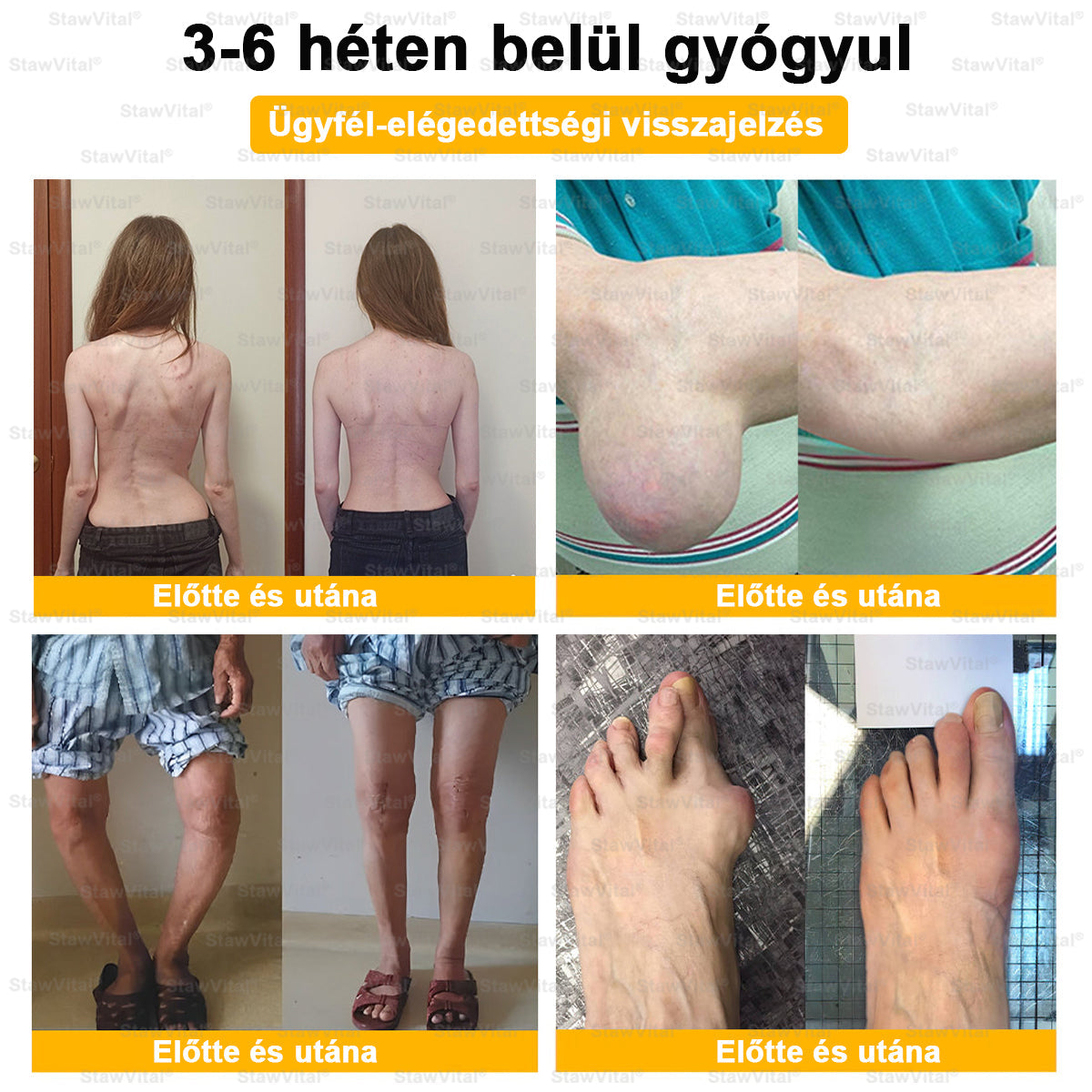 🎁𝑺𝒕𝒂𝒘𝑽𝒊𝒕𝒂𝒍® Botoxot és Méhmérget Tartalmazó Regeneráló Krém Ízületekre és Csontokra |✨ MOT (Magyar Ortopéd Társaság) által tanúsított termék